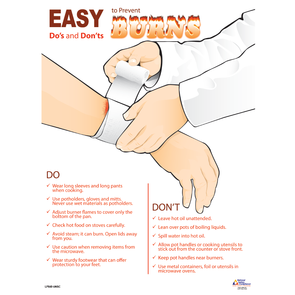 Easy to Prevent Burns Safety Poster 